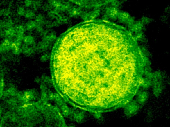 HKU to Co-ordinate MERS Study in Theme-based Research Scheme